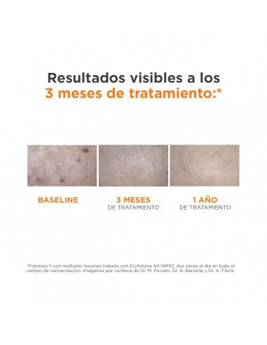Isdin Fotoprotección Eryfotona... Isdin Fotoprotección Eryfotona...