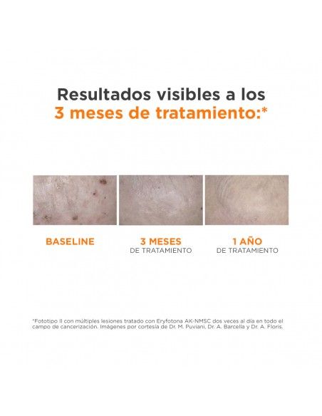 Isdin Fotoprotección Eryfotona AK-NMSC Fluid SPF 100+ 50 ml