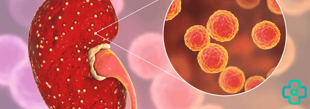 Diferencia entre infección de orina y candidiasis