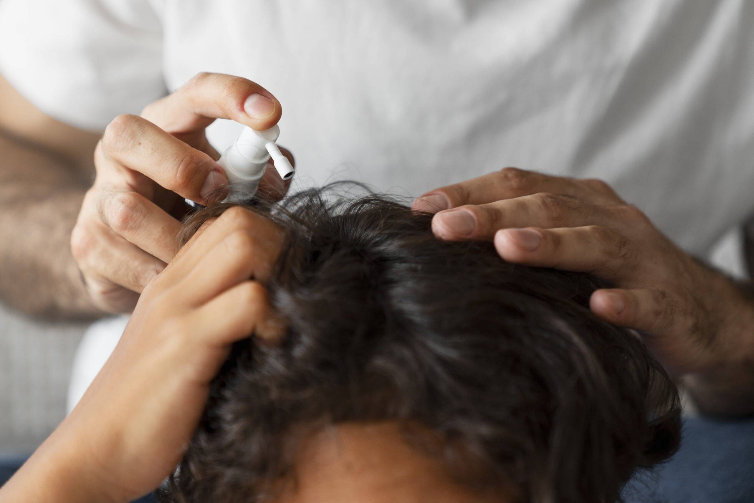 Causas de la caída del cabello en hombres y mujeres