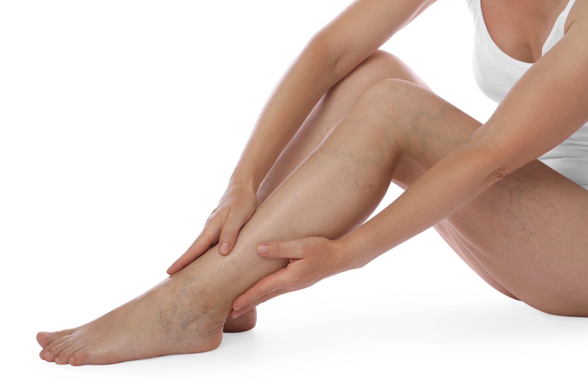 Qué tomar para las varices: pastillas, cremas y hábitos que ayudan